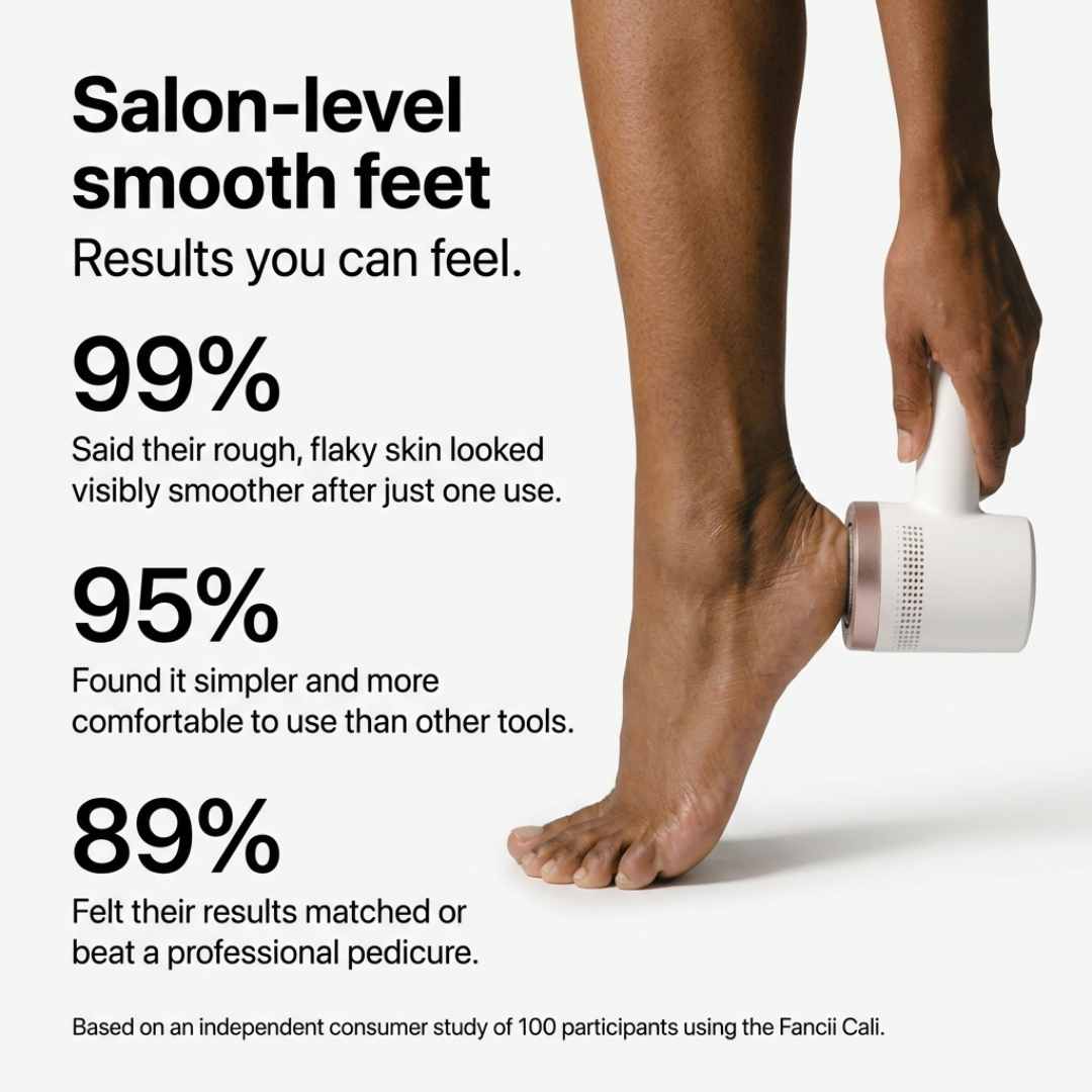 Cali Electric Callus Remover - Image 8