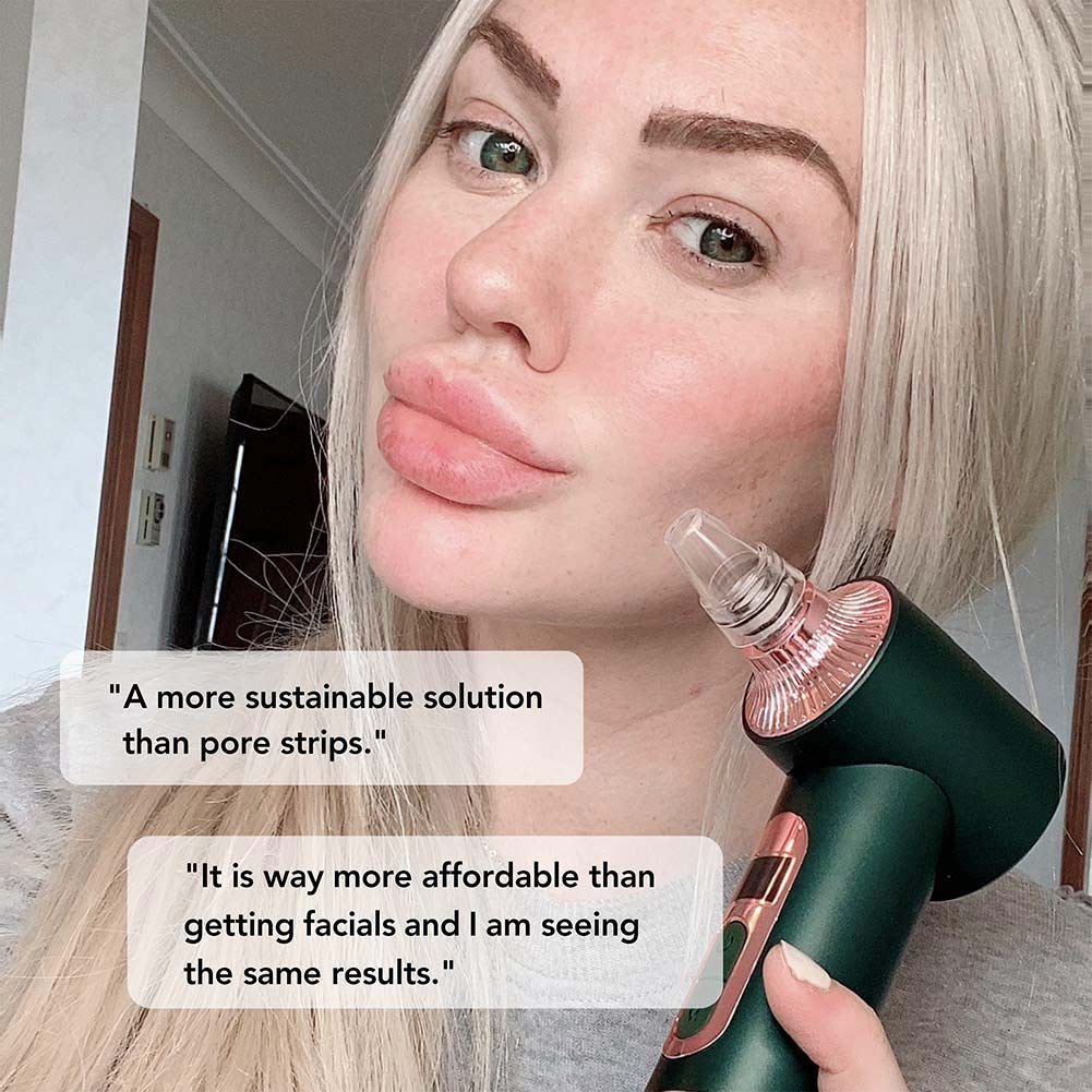 Clara Microdermabrasion Device - Image 17