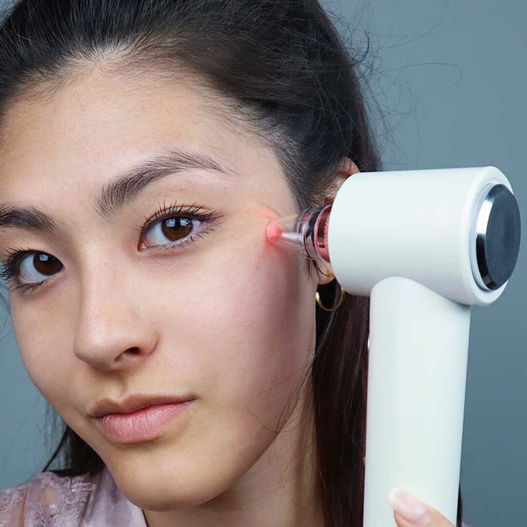 Clara Microdermabrasion Device - Image 16